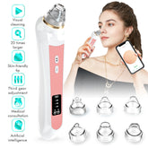 High definition visual electric blackhead absorber